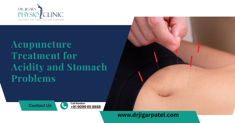  Acupuncture Treatment for Acidity 
