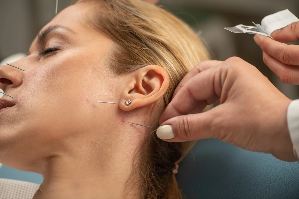 Why Acupuncture is Important for Every Condition 