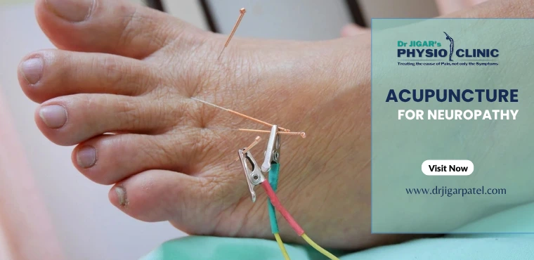 Acupuncture for Neuropathy Treatment 