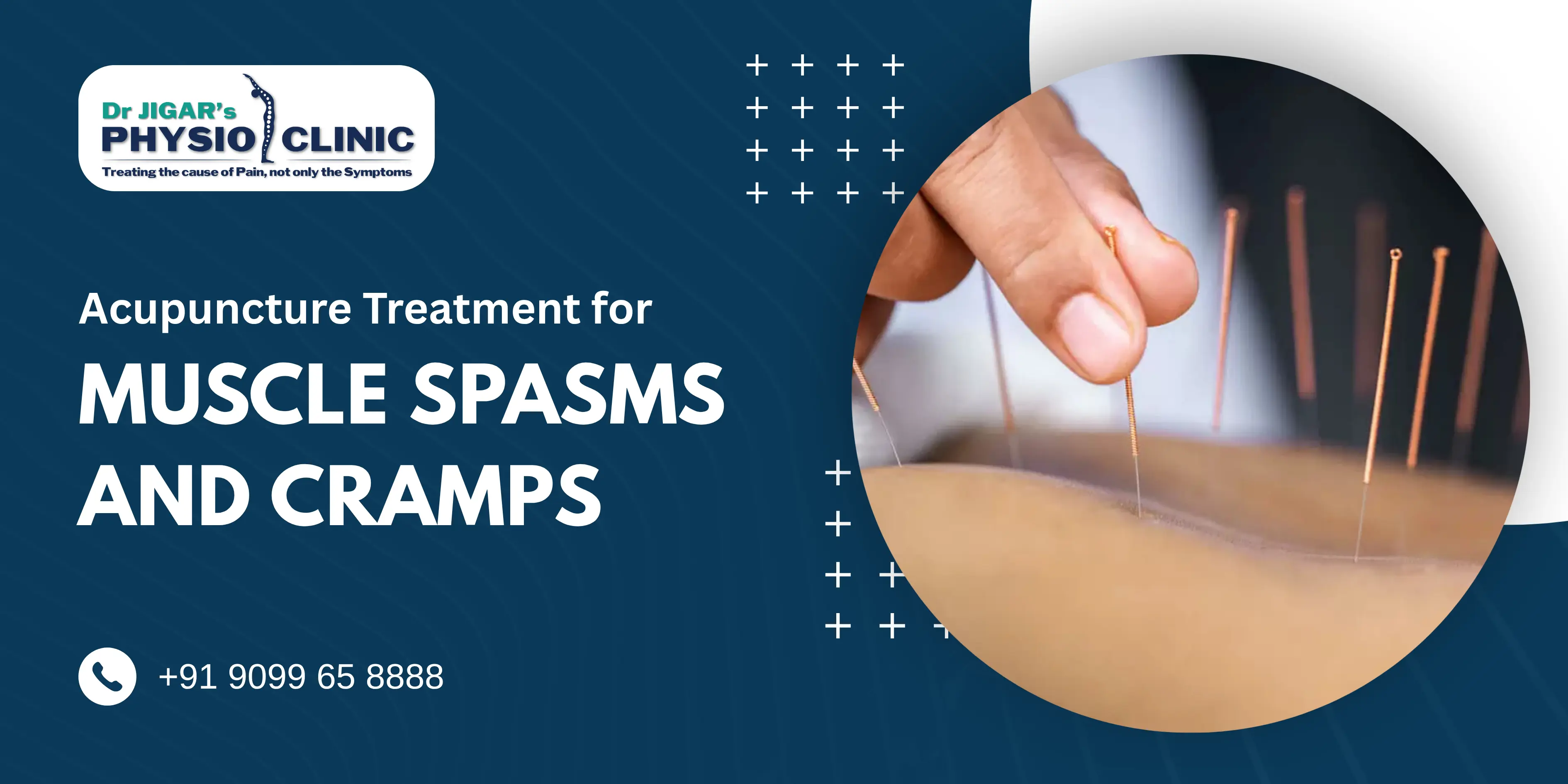 Acupuncture Treatment for Muscle Spasms and Cramps 