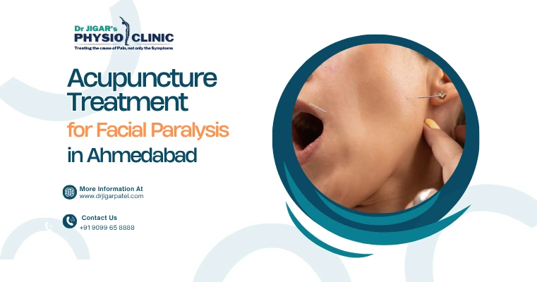 Acupuncture Treatment for Facial Paralysis   Acupuncture Treatment for Facial Paralysis