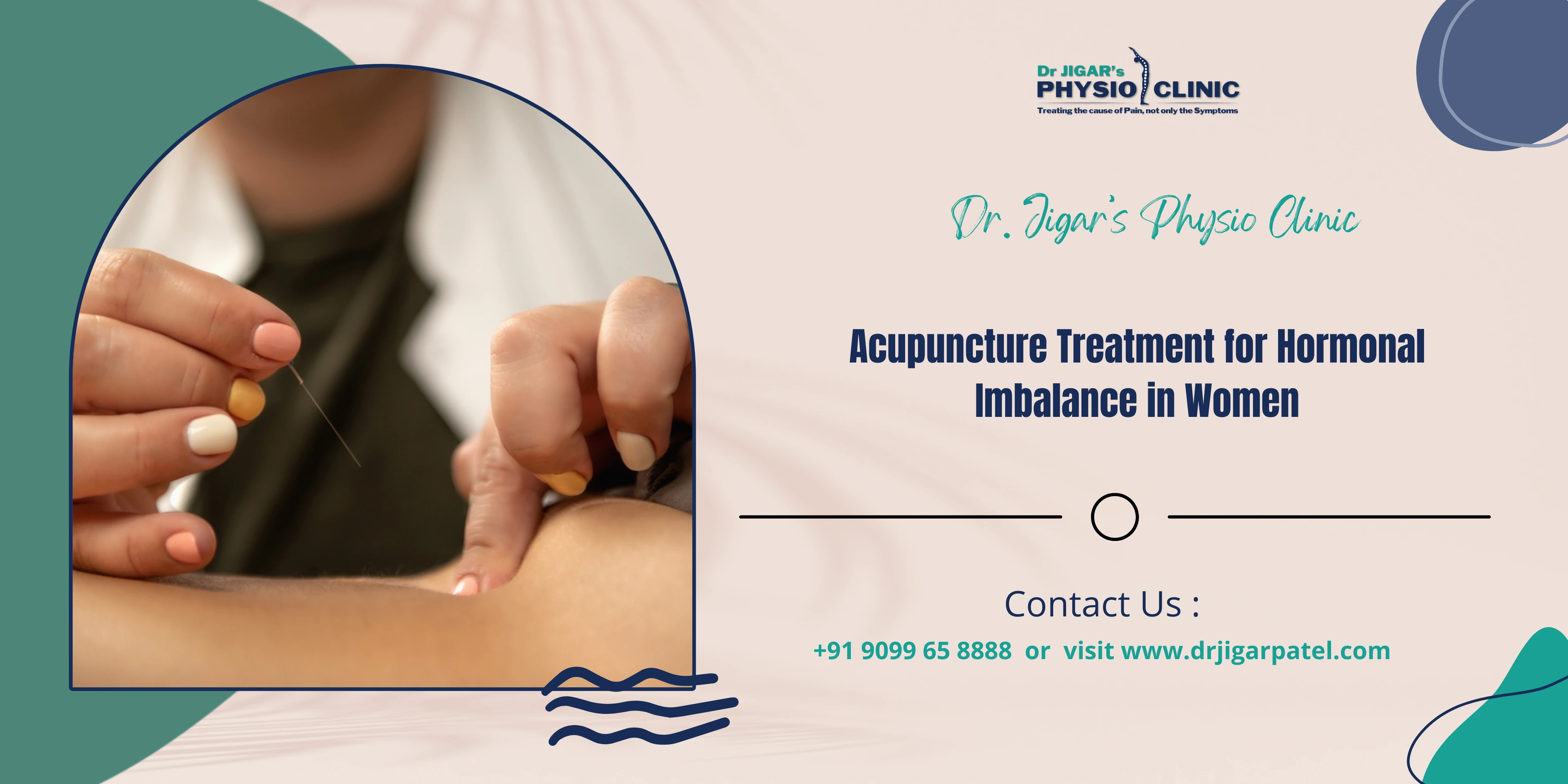  Best Acupuncture Treatment for Hormonal Imbalance in Women 