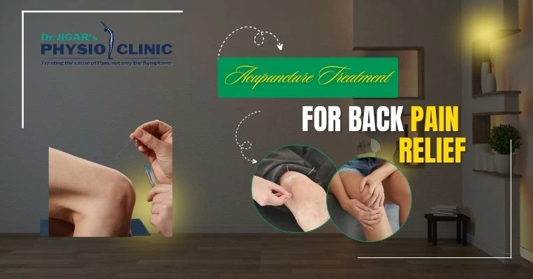  Acupuncture Treatment for Knee Pain in Ahmedabad 
