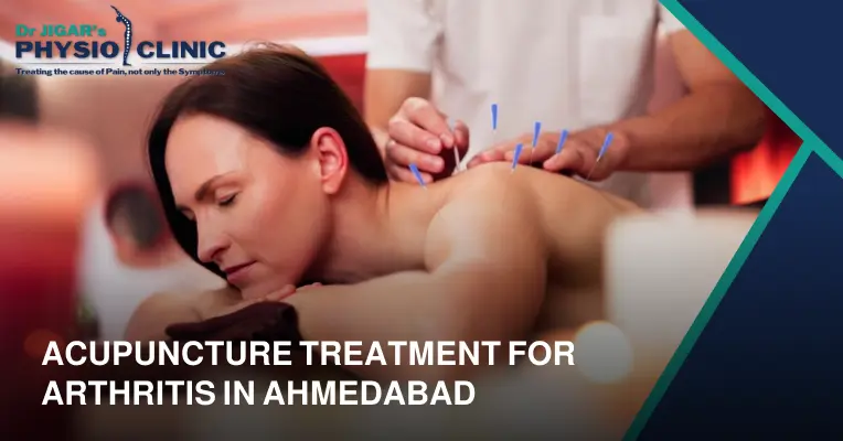  Acupuncture Treatment for Arthritis in Ahmedabad