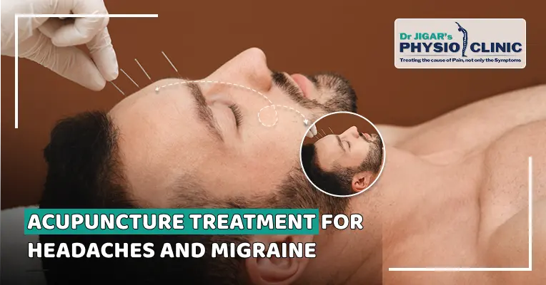  Acupuncture Treatment for Headaches and Migraine in Ahmedabad 