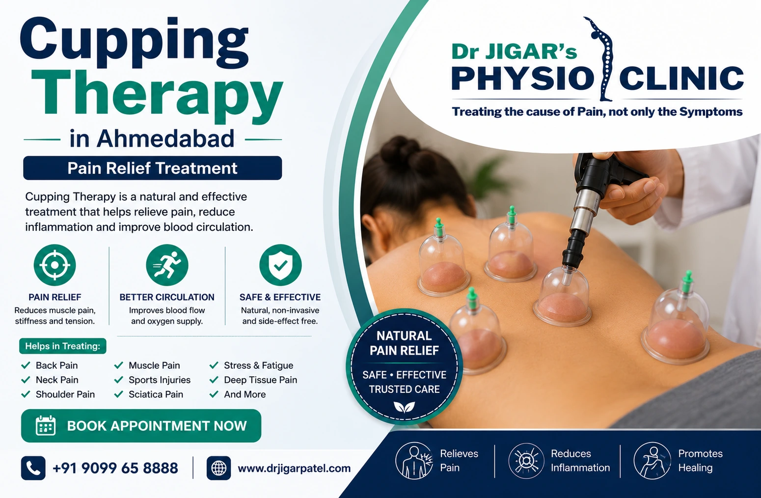 Cupping Therapy Treatment in Ahmedabad 